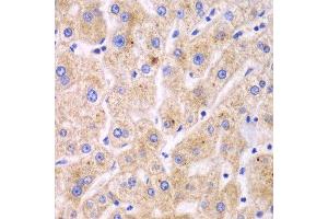 Immunohistochemistry of paraffin-embedded human liver injury using TXNRD2 antibody. (TXNRD2 抗体  (AA 100-310))