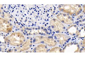 Detection of CASP9 in Human Kidney Tissue using Polyclonal Antibody to Caspase 9 (CASP9) (Caspase 9 抗体  (AA 331-416))