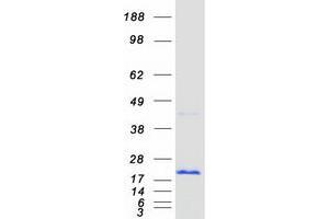 Western Blotting (WB) image for CCHC-Type Zinc Finger, Nucleic Acid Binding Protein (CNBP) (Transcript Variant 3) protein (Myc-DYKDDDDK Tag) (ABIN2712903)