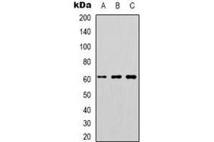 Western blot analysis of DOK1 expression in K562 (A), Jurkat (B), RAW264. (DOK1 抗体)