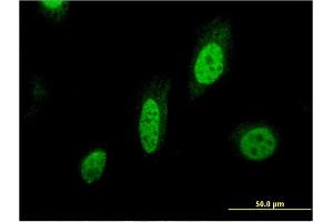 Immunofluorescence of monoclonal antibody to BIRC7 on HeLa cell. (BIRC7 抗体  (AA 1-90))
