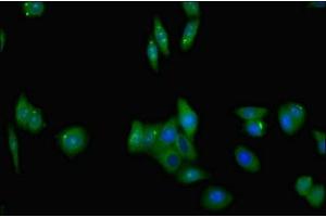 Immunofluorescent analysis of HepG2 cells using ABIN7173833 at dilution of 1:100 and Alexa Fluor 488-congugated AffiniPure Goat Anti-Rabbit IgG(H+L)