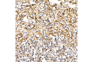 Immunohistochemistry of paraffin-embedded human spleen using BST2 Rabbit pAb (ABIN6129547, ABIN6137673, ABIN6137675 and ABIN6215924) at dilution of 1:100 (40x lens). (BST2 抗体  (AA 49-161))