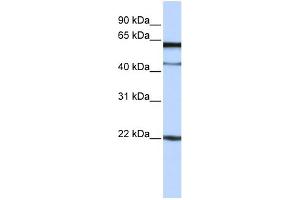 WB Suggested Anti-C6orf25 Antibody Titration:  0. (C6orf25 抗体  (N-Term))