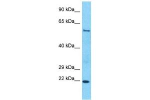 Host:  Rabbit  Target Name:  SLC43A2  Sample Type:  Esophagus Tumor lysates  Antibody Dilution:  1.