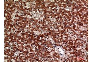 Immunohistochemistry (IHC) analysis of paraffin-embedded Human Liver, antibody was diluted at 1:100. (CD63 抗体  (Internal Region))