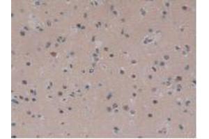 IHC-P analysis of Human Brain Tissue, with DAB staining. (IGFBPI 抗体  (AA 36-235))