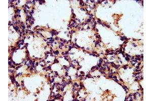 IHC image of ABIN7142118 diluted at 1:300 and staining in paraffin-embedded human lung tissue performed on a Leica BondTM system. (TNKS1BP1 抗体  (AA 271-375))