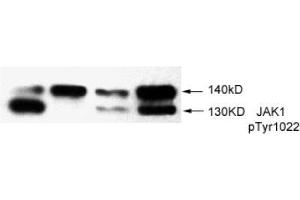 Image no. 2 for anti-Janus Kinase 1 (JAK1) (pTyr1022) antibody (ABIN196868) (JAK1 抗体  (pTyr1022))