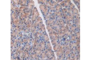 Immunohistochemistry (IHC) image for anti-Occludin/ELL Domain Containing 1 (OCEL1) (AA 1-86) antibody (ABIN5014045)