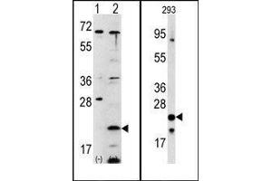 (LEFT)Western blot analysis of FXN (arrow) using rabbit polyclonal FXN Antibody (C-term). (Frataxin 抗体  (C-Term))