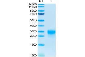 Human TSLP (R127A, R130A) on Tris-Bis PAGE under reduced condition. (Thymic Stromal Lymphopoietin Protein (TSLP) (AA 29-159, Arg127Ala-Mutant, Arg130Ala-Mutant) (His-Avi Tag))
