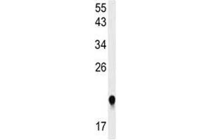 Western Blotting (WB) image for anti-IMP3, U3 Small Nucleolar Ribonucleoprotein (IMP3) (AA 156-184) antibody (ABIN3028732)
