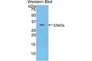 Western blot analysis of the recombinant protein. (CD103 抗体  (AA 671-917))
