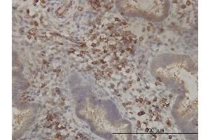 Immunoperoxidase of monoclonal antibody to PANK2 on formalin-fixed paraffin-embedded human endometrium tissue. (PANK2 抗体  (AA 205-260))