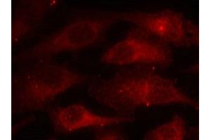 Immunofluorescence staining of methanol-fixed Hela cells using Caveolin-1(Phospho-Tyr14) Antibody. (Caveolin-1 抗体  (pTyr14))
