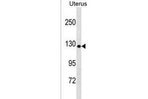 COL19A1 Antibody (N-term) (ABIN1539125 and ABIN2850306) western blot analysis in Uterus tissue lysates (35 μg/lane).
