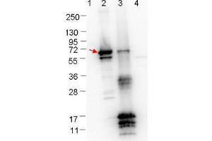 Western blot showing detection of 0. (ErpN/OspE 抗体)