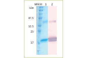 SDS-PAGE and Western blot analysis of human recombinant IFN-alpha- 2a.