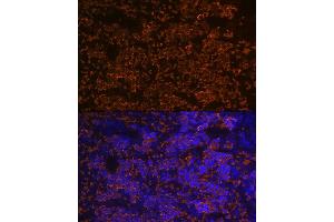 Immunofluorescence analysis of rat spleen using Hemoglobin subunit alpha (HB) (HB) Rabbit mAb (ABIN7267608) at dilution of 1:100 (40x lens).