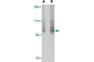 Western blot analysis of TNPO3 in rat liver tissue lysate with TNPO3 polyclonal antibody  at (A) 1 and (B) 2 ug/mL . (Transportin 3 抗体  (N-Term))