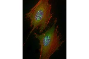 Immunofluorescent analysis of 4 % paraformaldehyde-fixed, 0. (IRAK1 抗体  (pSer376))