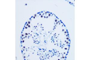Immunohistochemistry of paraffin-embedded Mouse testis using Asymmetric DiMethyl-Histone H3-R8 Rabbit pAb (ABIN3017485, ABIN3017486, ABIN3017487 and ABIN6220109) at dilution of 1:100 (40x lens).
