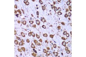 Immunohistochemistry of paraffin-embedded mouse brain using RPS10 antibody at dilution of 1:100 (x40 lens). (RPS10 抗体)