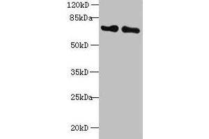 Western blot All lanes: KEAP1 antibody at 2 μg/mL Lane 1: Mouse kidney tissue Lane 2: NIH/3T3 whole cell lysate Secondary Goat polyclonal to rabbit IgG at 1/10000 dilution Predicted band size: 70 kDa Observed band size: 70 kDa (KEAP1 抗体  (AA 1-624))