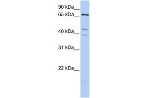 WB Suggested Anti-IPP Antibody Titration: 0. (IPP 抗体  (C-Term))