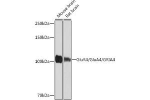 Western blot analysis of extracts of various cell lines, using GluR4/Glu/GRIRabbit mAb (593) at 1:1000 dilution. (GRIA4 抗体)