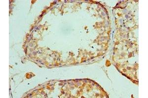 Immunohistochemistry of paraffin-embedded human testis tissue using ABIN7150716 at dilution of 1:100 (MAP2K5 抗体  (AA 1-190))