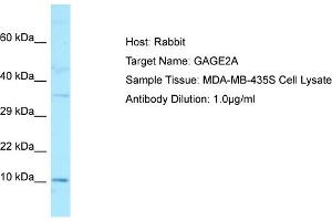 Host: RabbitTarget Name: GAGE2AAntibody Dilution: 1.