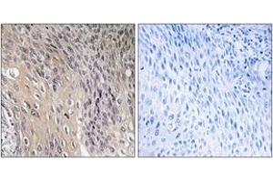 Immunohistochemistry (IHC) image for anti-rho GDP Dissociation Inhibitor (GDI) alpha (ARHGDIA) (AA 140-189), (pSer174) antibody (ABIN1531733)