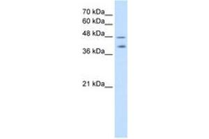 Image no. 1 for anti-Pregnancy Specific beta-1-Glycoprotein 1 (PSG1) (AA 351-400) antibody (ABIN204993) (PSG1 抗体  (AA 351-400))