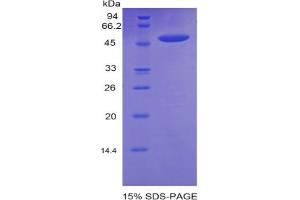 SDS-PAGE analysis of Rat Cadherin, Heart Protein. (Cadherin 13 Protein (CDH13))