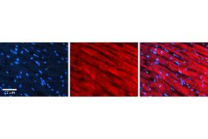 Immunohistochemistry (IHC) image for anti-Sterol Regulatory Element Binding Transcription Factor 2 (SREBF2) (Middle Region) antibody (ABIN2774656)