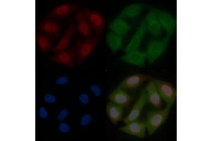 Phospho-FOXO1A (Ser329) Mouse Monoclonal Antibody staining Hela cells by IF/ICC. (FOXO1 抗体  (pSer329))