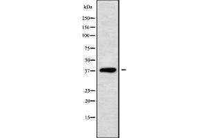 Western blot analysis of DHRS7 using Jurkat whole cell lysates (DHRS7 抗体  (C-Term))
