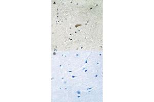 Immunohistochemical staining of human brain tissue by FRS2 (phospho Y436) polyclonal antibody  without blocking peptide (A) or preincubated with blocking peptide (B) under 1:50-1:100 dilution. (FRS2 抗体  (pTyr436))