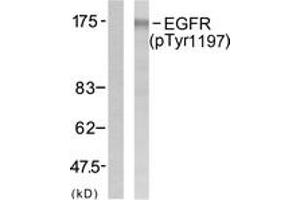 Western blot analysis of extracts from A431 cells treated with EGF 40 muM 10', using EGFR (Phospho-Tyr1197) Antibody. (EGFR 抗体  (pTyr1197))