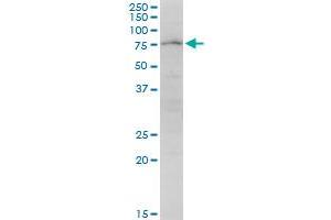 Western Blotting (WB) image for anti-Poly A Specific Ribonuclease (PARN) (AA 1-639) antibody (ABIN518621)