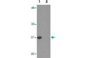 Western blot analysis of TMEM59 in human kidney tissue lysate with TMEM59 polyclonal antibody  at 1 ug/mL in (1) the absence and (2) the presence of blocking peptide. (TMEM59 抗体  (N-Term))