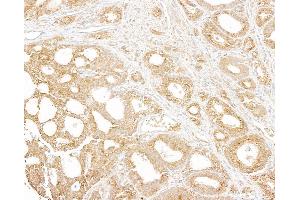 anti-Ubiquitin Protein Ligase E3 Component N-Recognin 4 (UBR4) (AA 1350-1400) antibody