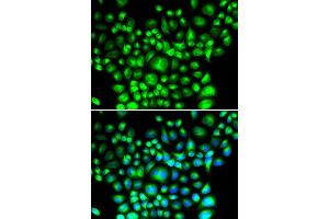 Immunofluorescence analysis of U2OS cells using BCAP31 antibody. (BCAP31 抗体  (AA 127-246))