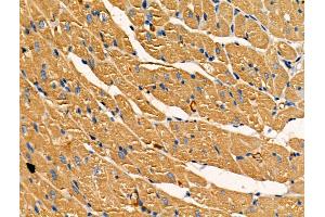 ABIN7093234 and ABIN7097246 at 1/100 staining Rat heart tissue by IHC-P. (SOD2 抗体  (acLys68))