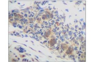 Image no. 3 for anti-Chemokine (C-X-C Motif) Ligand 14 (CXCL14) antibody (ABIN181664) (CXCL14 抗体)