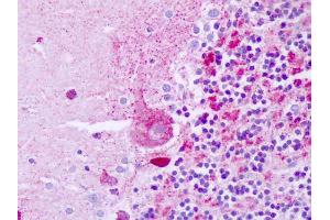 Anti-Killer / DR5 antibody IHC of human brain, cerebellum.