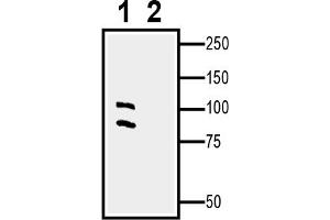 1. (EPH Receptor A5 抗体  (Extracellular, N-Term))