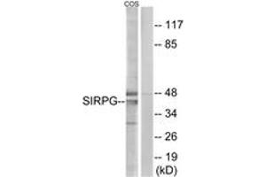 Western blot analysis of extracts from COS cells, using SIRPG Antibody. (SIRPG 抗体  (AA 101-150))